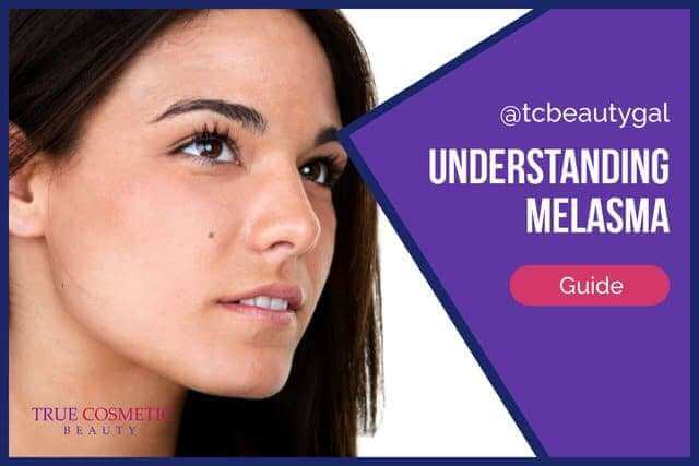 Understanding Melasma