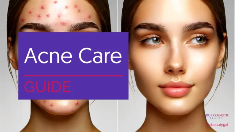 Complete Guide to Acne Care – Prevention, Treatment, and Skincare Tips